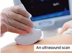  ?? ?? An ultrasound scan