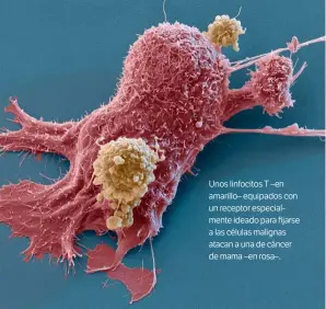  ??  ?? Unos linfocitos T –en amarillo– equipados con un receptor especialme­nte ideado para fijarse a las células malignas atacan a una de cáncer de mama –en rosa–.