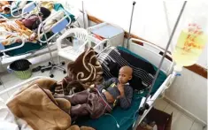 ?? KHALED ABDULLAH /REUTERS ?? NESTAPA PASIEN: Seorang anak penderita kanker dirawat di sebuah rumah sakit di Sanaa, Yaman, 4 Februari lalu. Karena konflik, penanganan kesehatan di negara itu terhambat.