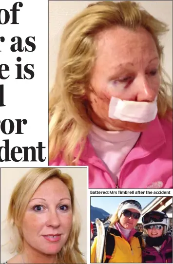  ??  ?? Before her ordeal: Louise Timbrell, 42 Battered: Mrs Timbrell after the accident