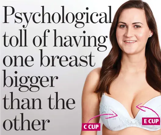  ??  ?? Mismatch: Leah Knight, 24, is self-conscious of her uneven cleavage
