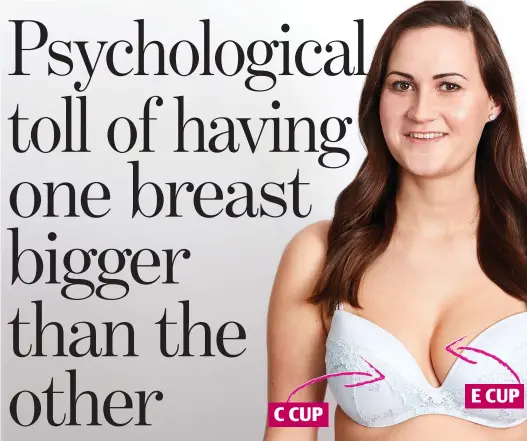 Woman with one breast larger than the other says she won't be having surgery