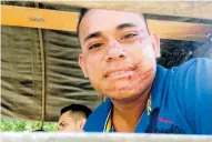  ?? JOHNY OLIVARES ?? Un joven resultó lesionado en la cara durante la pelea.