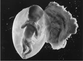  ??  ?? Prenatal journey … Foetus 18 weeks, by Lennart Nilsson. Photograph: Lennart Nilsson Photograph­y