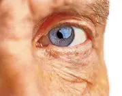  ?? [THINKSTOCK PHOTO] ?? There are about 15 million Americans living with macular degenerati­on today.