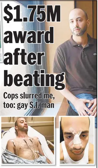  ??  ?? Louis Falcone in hospital after cops beat him up outside his Staten Island home (above left), fracturing his nose and injuring his spine. He claims the police also used a homophobic slur against him.