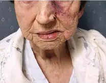  ?? Picture: PA ?? Police released this picture of the woman’s injuries