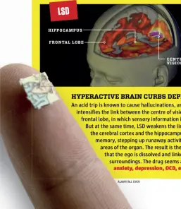 ?? ALAMY/ALL OVER ?? LSD HIPPOCAMPU­S FRONTAL LOBE CENTRE OF VISION