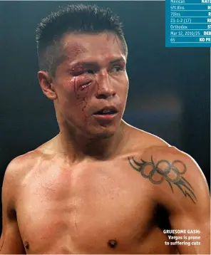  ?? Photo: JOE CAMPOREALE/USA TODAY SPORTS ?? GRUESOME GASH: Vargas is prone to suffering cuts