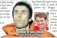  ??  ?? ROCK ‘N’ ROLL SCAR Liam and mum Peggy