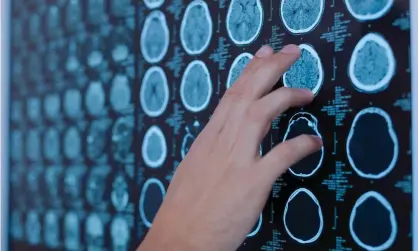  ?? Dmytro Zinkevych/Alamy ?? New Brunswick officials last year flagged a possible ‘cluster’ of residents suffering from an unknown neurologic­al syndrome. Photograph: