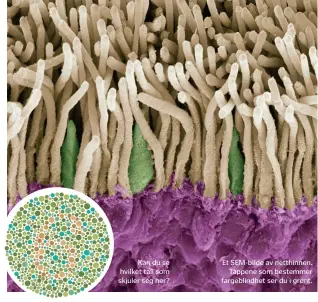  ??  ?? Kan du se hvilket tall som skjuler seg her? Et SEM- bilde av netthinnen.
Tappene som bestemmer fargeblind­het ser du i grønt.