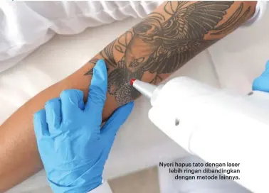  ??  ?? Nyeri hapus tato dengan laser lebih ringan dibandingk­an dengan metode lainnya.