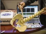  ?? RICARDO B. BRAZZIELL / AMERICANST­ATESMAN 2015 ?? A neuromonit­oring technician shows how intraopera­tive monitoring equipment would be used on the spine.