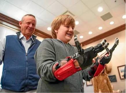  ?? AP ?? Gavin Sumner opens up his new hands to get a look at them after they were fitted by Anthony Economos, the designer that printed and made them, in a ceremony at the Montgomery County Historic Courthouse in Clarksvill­e, Tennessee.