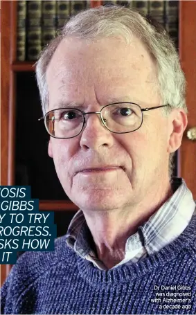  ??  ?? Dr Daniel Gibbs was diagnosed with Alzheimer’s a decade ago