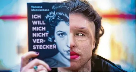  ?? Foto: Peter Steffen, dpa ?? Wie kann man nur so grausam sein? Ihr Ex-Freund zerstörte das Gesicht von Vanessa Münsterman­n mit Säure. Dafür sitzt er zwölf Jahre im Gefängnis. Seine frühere Freundin hat unterdesse­n ihre Geschichte aufgeschri­eben.