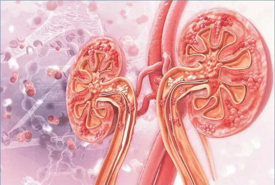  ?? DREAMSTIME ?? La fibrosis renal se caracteriz­a por un exceso de cicatrizac­ión del tejido que hace que se endurezca y pierda su función