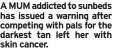  ?? ?? A MUM addicted to sunbeds has issued a warning after competing with pals for the darkest tan left her with skin cancer.