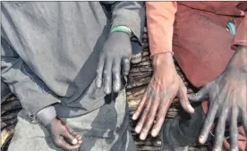  ??  ?? DANGEROUS: Workers use pangas to cut cane without any protective gloves.