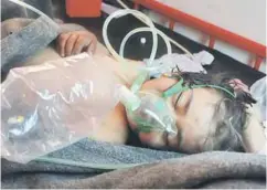  ??  ?? A Syrian child receives treatment following a suspected toxic gas attack in Khan Sheikhun, a rebel-held town in the northweste­rn Syrian Idlib province.