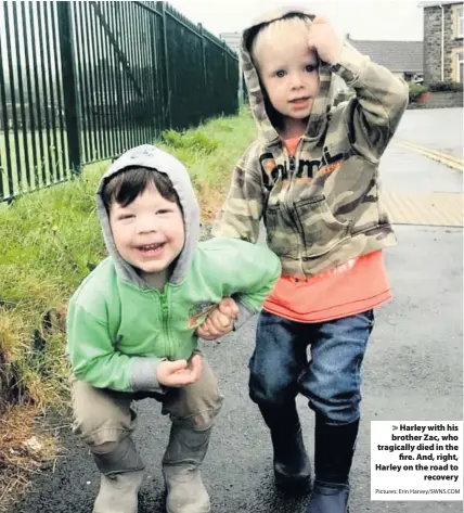  ?? Pictures: Erin Harvey/SWNS.COM ?? > Harley with his brother Zac, who tragically died in the fire. And, right, Harley on the road to recovery