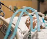  ?? JAE C. HONG/AP ?? Ventilator tubes are attached to a COVID-19 patient at Providence Holy Cross Medical Center in Los Angeles on Thursday.