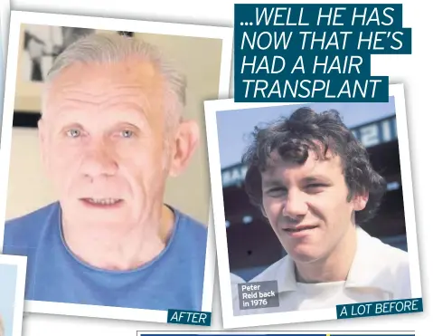  ??  ?? Peter Reid back in 1976 A LOT BEFORE AFTER