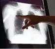  ?? Foto: dpa ?? Künftig könnten auch Röntgenbil­der Teil der digitalen Vernetzung sein.