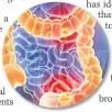  ??  ?? TARGET Bowel cancer cells