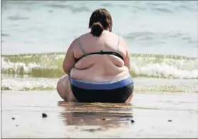  ?? Photo: Matt Cardy/Getty Images ?? Life at risk: Obesity has become a global epidemic, with more than 600-million adults classified as obese.