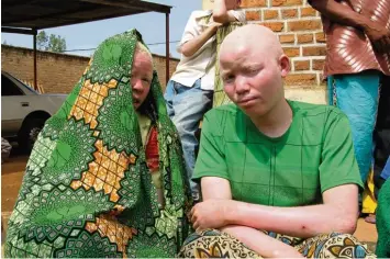  ?? Foto: Eva Krafczyk, dpa ?? In Afrika müssen viele Albinos um ihr Leben fürchten, so wie diese beiden Albinofrau­en in Burundi. Nun wurden zwei Männer ge tötet, weil sie Glatzen trugen.