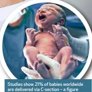  ??  ?? Studies show 21% of babies worldwide are delivered via C-section – a figure that’s tripled since 1990.