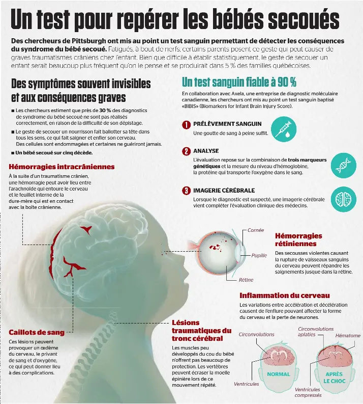 Un Test Pour Reperer Les Bebes Secoues Pressreader