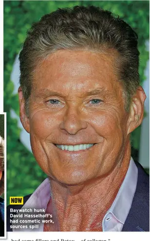  ?? ?? NOW
Baywatch hunk David Hasselhoff’s had cosmetic work, sources spill