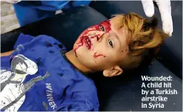  ??  ?? Wounded: A child hit by a Turkish airstrike in Syria