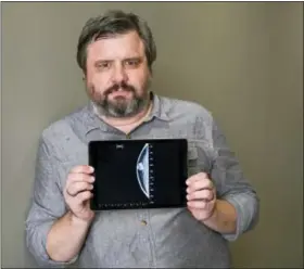  ?? RICHARD VOGEL / THE ASSOCIATED PRESS ?? Associated Press reporter Andrew Dalton holds an iPad displaying an image of his mammogram in downtown Los Angeles.