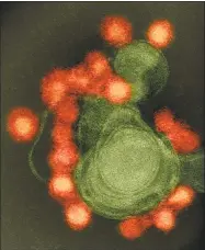  ?? Contribute­d photo ?? Transmissi­on electron microscope image of negative-stained, Fortaleza-strain Zika virus (red), isolated from a microcepha­ly case in Brazil