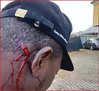  ??  ?? Owoupele Bobolayefa, SA to the governor allegedly attacked in Yenagoa