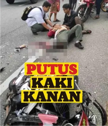  ??  ?? MANGSA putus kaki kanan selepas motosikal ditunggang­nya merempuh belakang sebuah lori ais di Kilometer 8, Jalan Taiping-Selama.