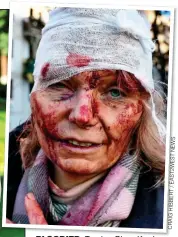  ?? CRAIGHIBBE­RT/EAST2WESTN­EWS ?? BLOODIED: Teacher Olena Kurylo today, left, and above, the photo of her injuries that shocked the world