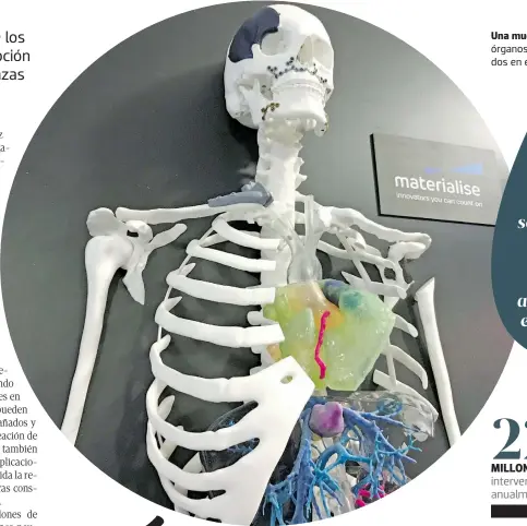  ??  ?? Una muestra de cómo se ven los órganos ya impresos en 3-D colocados en el interior de un esqueleto.