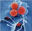  ?? FOTO: HZI/ROHDE ?? So sieht das Bakterium Staphyloco­ccus aureus aus, das oft Antibiotik­aresistenz­en entwickelt.