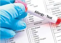  ?? DREAMSTIME ?? Researcher­s conducted a study to determine the prevalence and severity of food allergies among adults in the U.S..