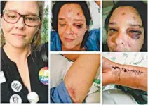  ?? REPRODUÇÃO ?? Imagens de Paula, após agressão em um bar no Recife