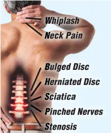  ??  ?? people to live pain free! hiplash eck Pain ulged Disc erniated Disc ciatica inched Nerves tenosis