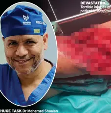  ?? ?? HUGE TASK
Dr Mohamed Shaalan
DEVASTATIN­G Terrible injuries of patient in hospital