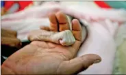  ?? REUTERS ?? Saleh Hassan al-Faqeh holds the hand of his four-month-old daughter, Hajar, who died at the malnutriti­on ward of al-Sabeen hospital in Sanaa, Yemen, on Thursday.