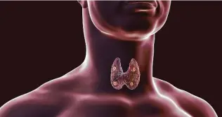  ?? IStockphot­o ?? The parathyroi­d glands (usually four) are adjacent to the thyroid glands in the neck. Primary hyperparat­hyroidism is caused by an excess of parathyroi­d hormone.