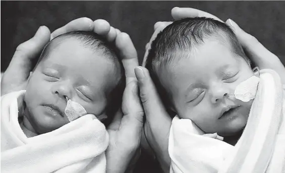  ??  ?? Charlotte and Olivia have been diagnosed with leukaemia after being born at 32 weeks.